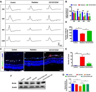 Human Umbilical Cord Blood-Derived CD133+CD34+ Cells Protect Retinal Endothelial Cells and Ganglion Cells in X-Irradiated Rats through Angioprotective and Neurotrophic Factors